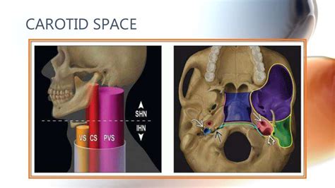 Ct Anatomy Of Neck Spaces Rv