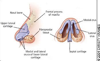 Inferior tuberinates (or nasal conchae; Learning Radiology - Fracture of the Nasal Bone, Nose