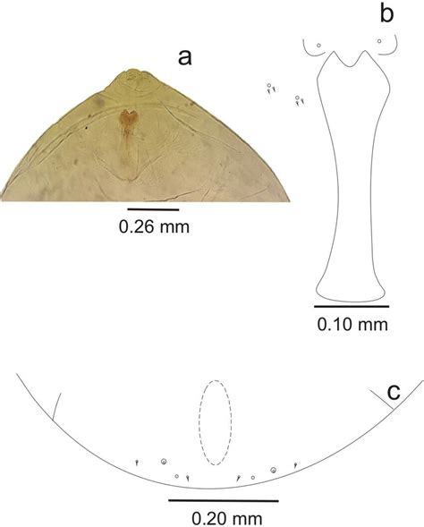 Cerciplanus Maricaensis Sp N Larva A Head And Prothoracic Spatula