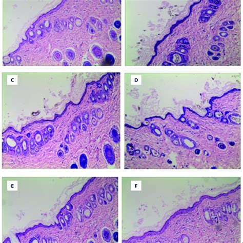 Before And After Modeling Of Guinea Pigs Skin Histopathological Images