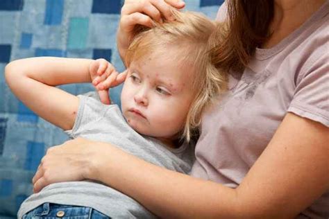 Demam denggi adalah sejenis penyakit jangkitan virus yang merebak melalui gigitan nyamuk aedes yang telah dijangkiti virus tersebut. Demam berdarah - Gejala, penyebab dan mengobati - Alodokter