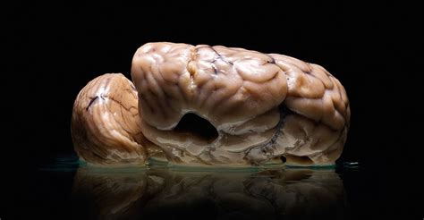 As you know, most of the deadly zombies are so into absorbing human brains. The Mysterious Vanishing Brains - The Atlantic