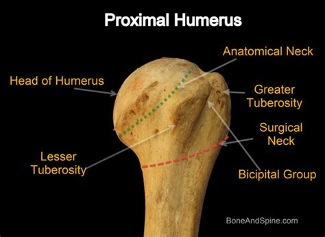 Proximal Humerus Fracture Anatomy