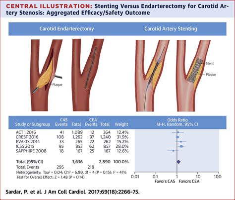 Carotid Artery Stenting Versus Endarterectomy For Stroke Prevention A
