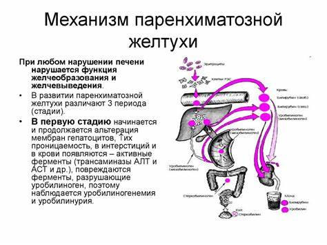 Желтуха а диета Типовые нарушения функций печени - презентация онлайн Типовые нарушения функций печени - презентация онлайн Желтуха а диета