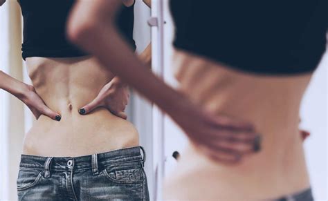 ¿qué Es La Anorexia Y Cómo Lidiar Con Ella Blog Clínica Internacional