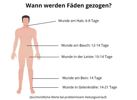 Oder schon ziehen wenn sie nur ein bisschen rausgucken bzw. Wann können Fäden von Wunden gezogen werden?