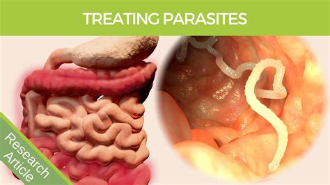 Symptoms Of Worms In Adults Parasite Cleanse Kit