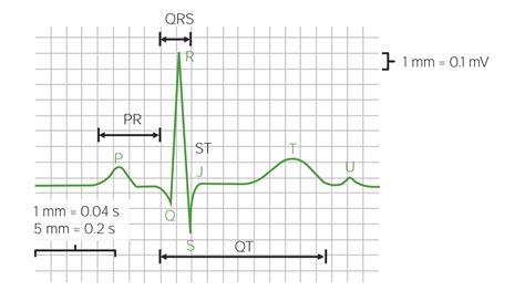How To Read An Ecg Interpretation And Components Lecturio Medical