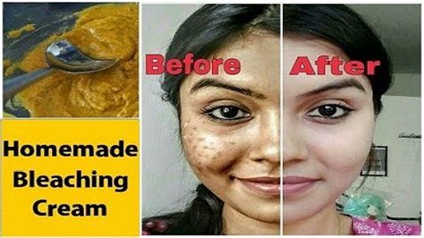 The founder of brooklyn face and eye, in the heart of brooklyn's prospect park, dr. Homemade Bleaching Cream For Skin Lightening and ...