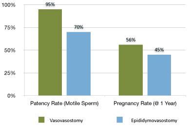 Vasectomy Reversal Success Rates Reverse Vasectomy Success Stories