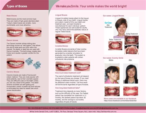 Types Of Braces Whitesmile Orthodontic Dental Braces Specialist Kuala