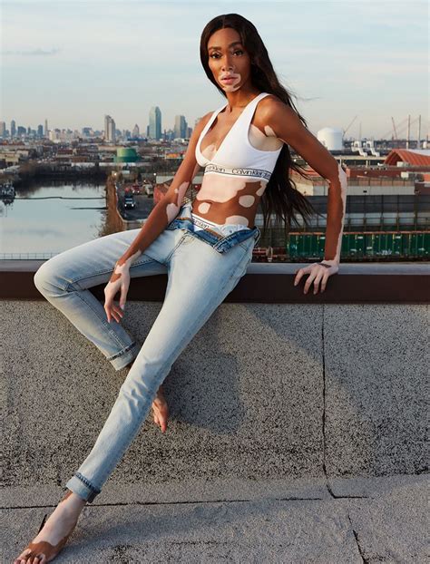 Winnie Harlow Takes A Bow As The Changing Face Of Beauty