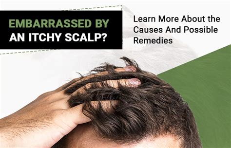 Embarrassed By An Itchy Scalp Learn More About Possible Remedies