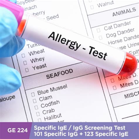 Why You Should Get An Allergy Test Discovering The Root Cause Of Your