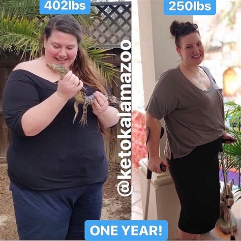 Keto Diet Weight Loss “i Lost 150 Pounds In A Year Without Stepping F