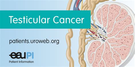 Testicular Cancer Patient Information