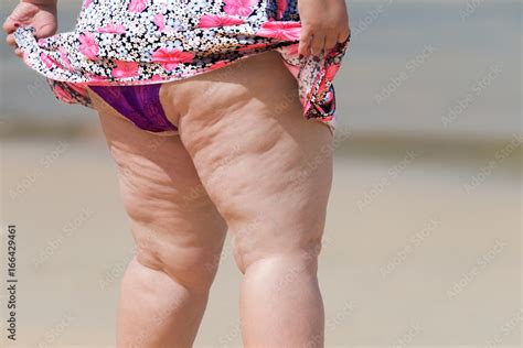 Lively Old Fat Woman In Swimwear On Sunny Beachcellulite Thigh Will