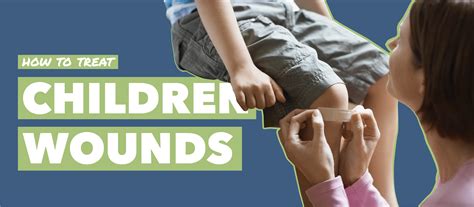 Wounds In Children How To Treat Them This Summer The Dermo Lab