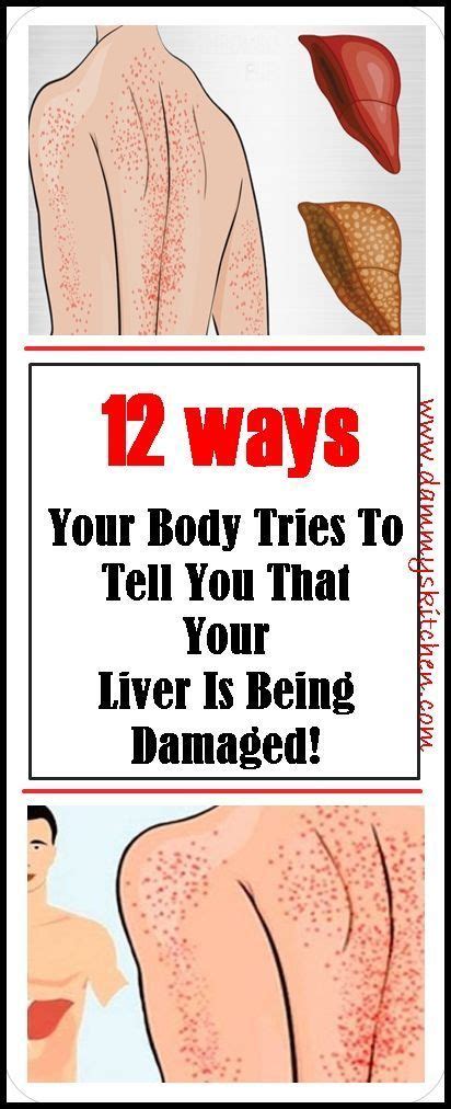 The kidneys filter things, such as water and. 12 WAYS YOUR BODY TRIES TO TELL YOU THAT YOUR LIVER IS BEING DAMAGED! in 2020 | Quadrants of the ...