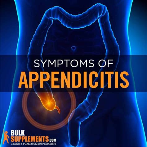 What Is Appendicitis Causes Symptoms Treatment