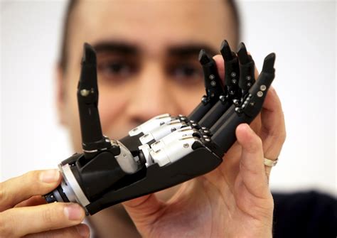 bionic-limbs-project-grabs-£1-4m-launch-funding