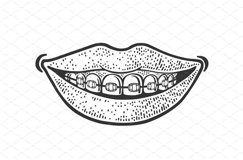 Dental Braces Smile Sketch Vector Healthcare Illustrations ~ Creative Market