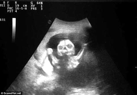 scared yet shares chilling ultrasounds images from mothers to be daily mail online