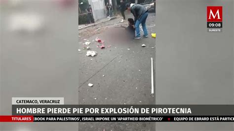 Hombre Pierde El Pie Por Explosión De Pirotecnia En Veracruz