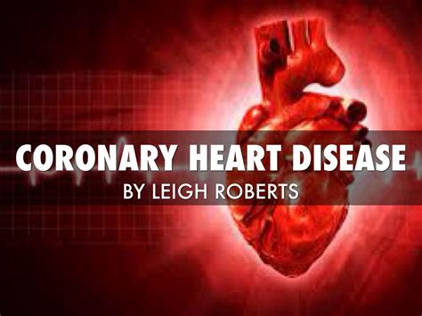 Coronary Heart Disease By Leigh Roberts