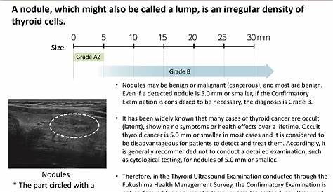 Thyroid Ultrasound Examination: Nodules [MOE]