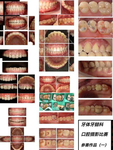 吉林大学口腔医院院牙体牙髓科举办口腔摄影比赛kq88口腔新闻