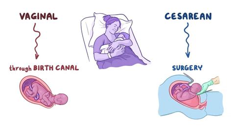 What Are The Differences Between Vaginal And Cesarean Deliveries My