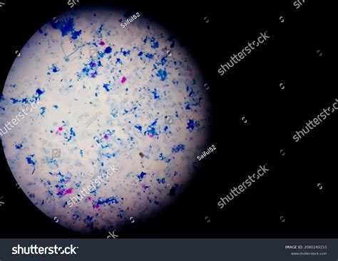 Sputum Smear Afb Stain Microscopic Close Stock Photo 2080240153
