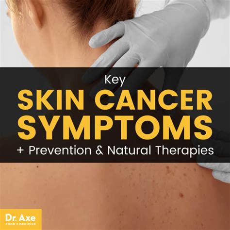 Skin Cancer Symptoms Prevention And Natural Therapies Dr Axe