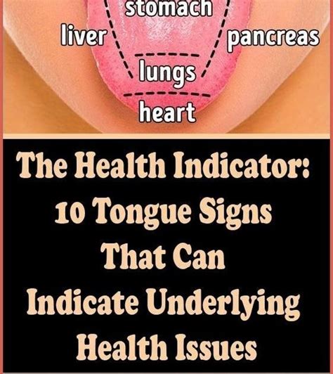 The Health Indicator 10 Tongue Signs That Can Indicate Underlying Health Issues Wellness Days