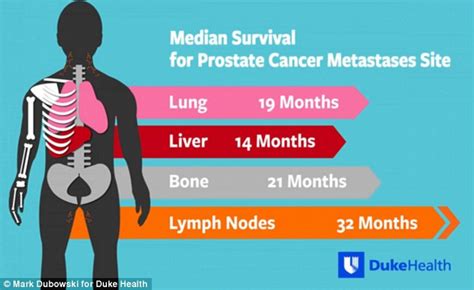 Where Prostate Cancer Spreads Determines How Long A Patient Will Survive Daily Mail Online