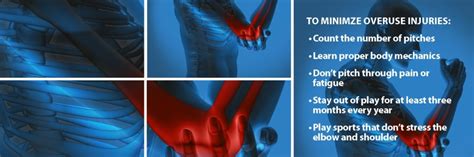 Elbow Injuries Florida Orthopaedic Institute