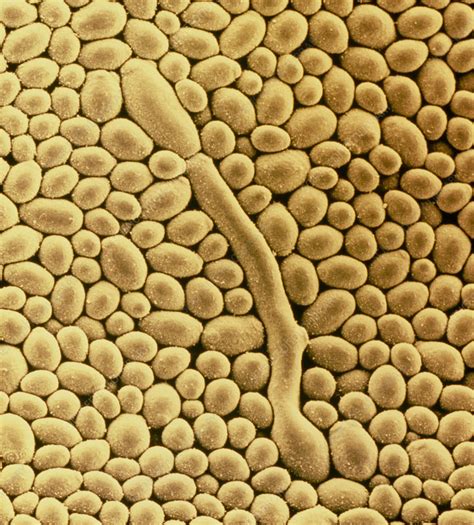 Yeast Cells Of Fungus Candida Albicans Stock Image B2500826