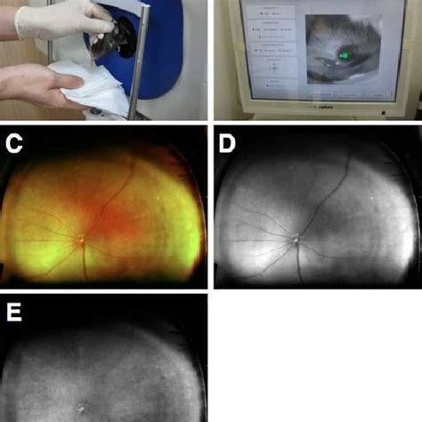 Optos Fluorescein Angiograph And Flat Mount Of Retinal Vessels A