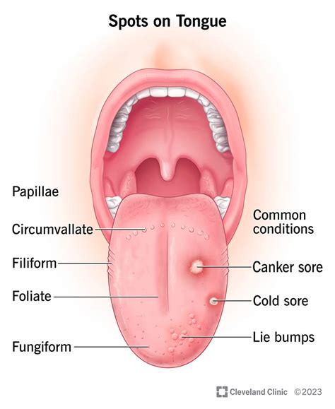 what those spots on your tongue mean hot sex picture