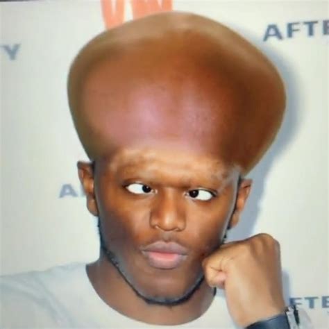 If Ksi Gets A Brain Behind That Big Ass Forehead Ksi
