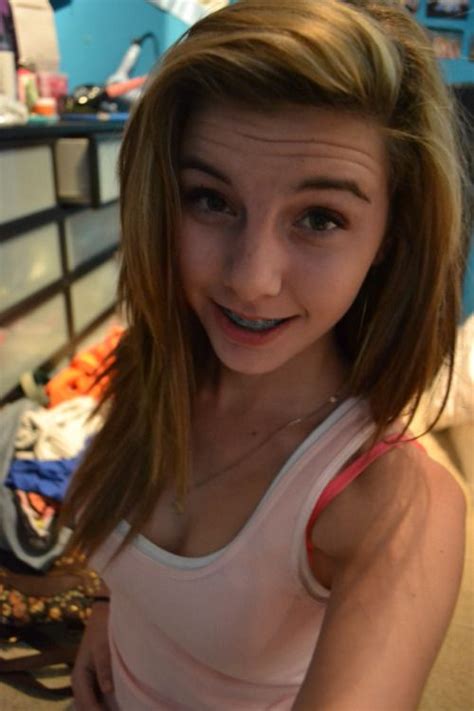 Girls With Braces Are Hot