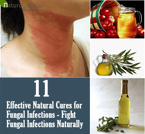 11 Effective Natural Cures For Fungal Infections Fight Fungal