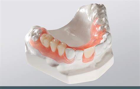 flexible partial dentures bayflex flexible dental partials