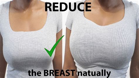Breast Reduction Without Surgery Renew Physical Therapy