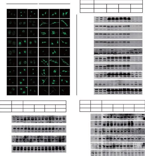 Ras Transformed Cells Show Restoration Of Psmad3c Mediated