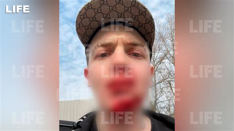 Рэпер yung trappa попал в дтп