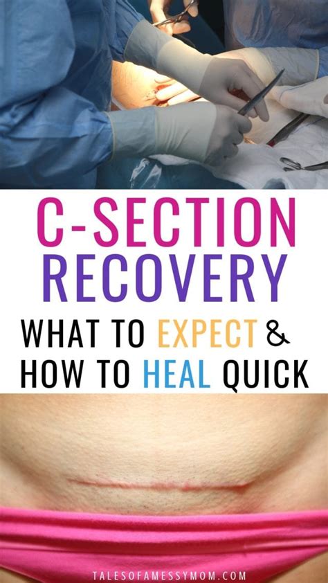 c section recovery tips to help you heal faster tales of a messy mom