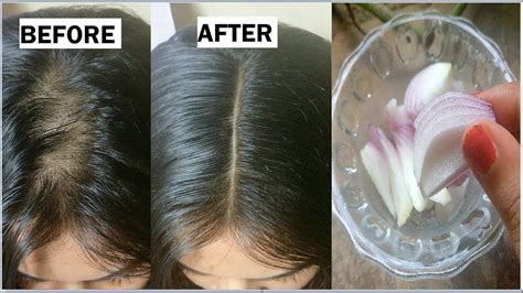 How To Grow Hair Faster Home Remedies Onion Michelle Hill Coiffure